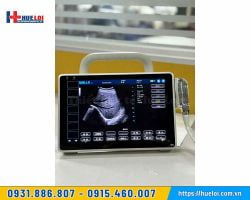 Máy siêu âm xách tay cảm ứng P10