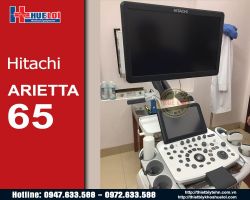 Máy siêu âm Hitachi Arietta 65