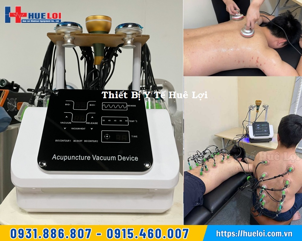 Máy điện châm không kim kèm giác hút điện xung