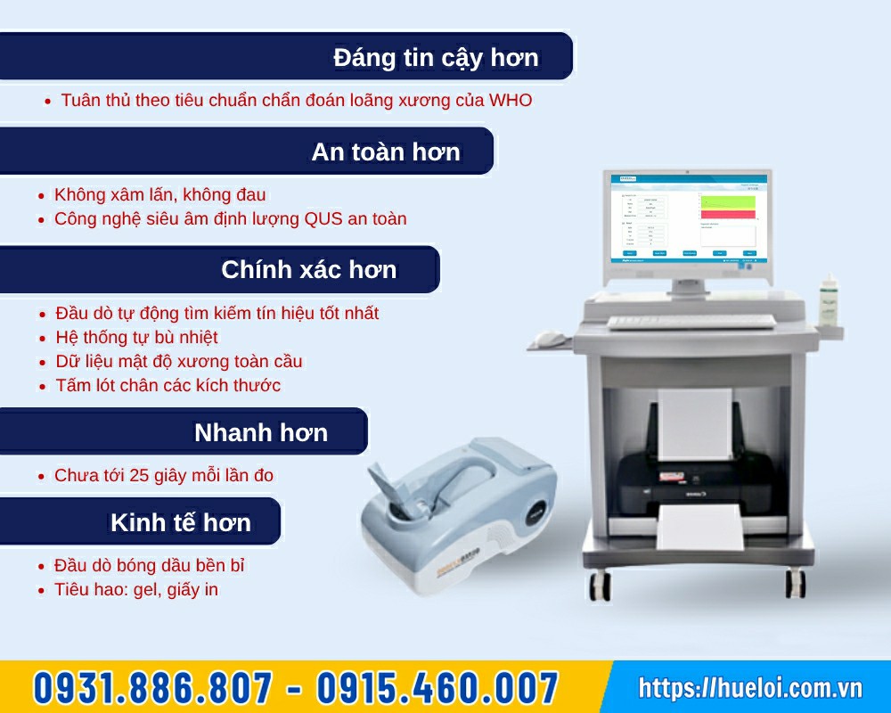 có nên mua máy đo loãng xương không 