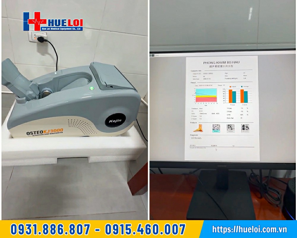 máy kiểm tra mật độ xương OSTEOKJ3000