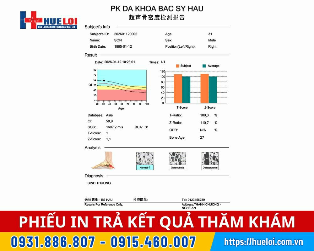 máy đo mật độ xương giá rẻ