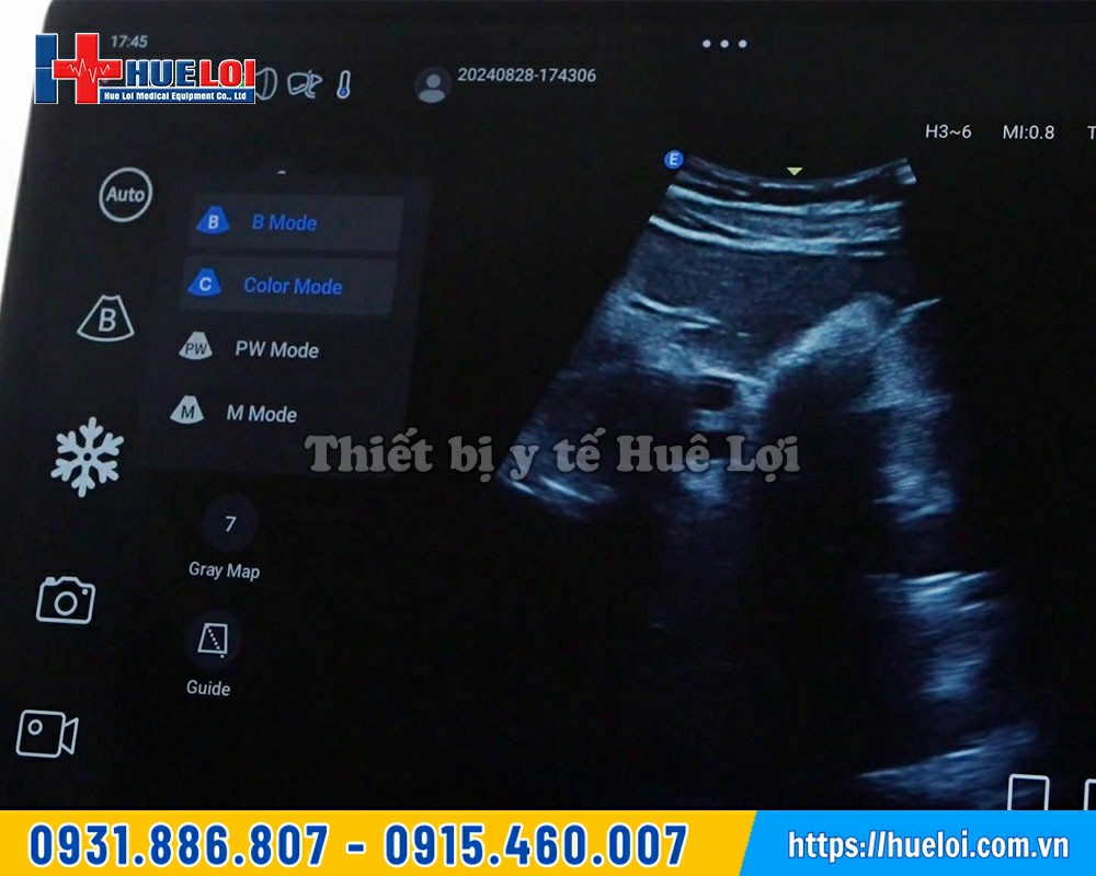 hình ảnh sử dụng máy siêu âm cầm tay L12