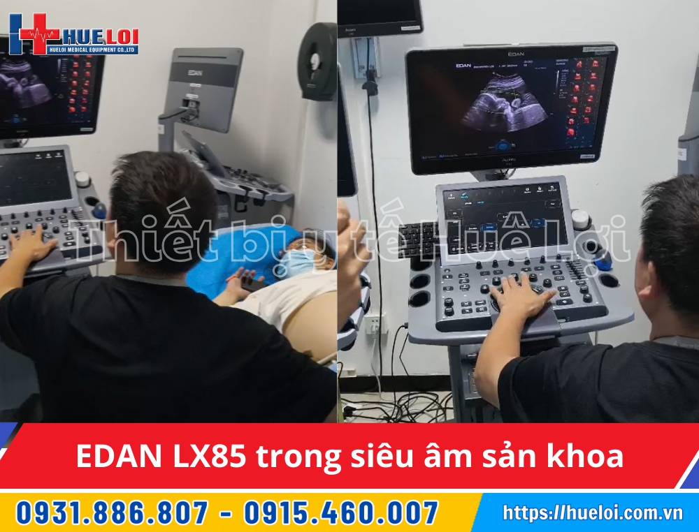 máy siêu âm phụ khoa lx85