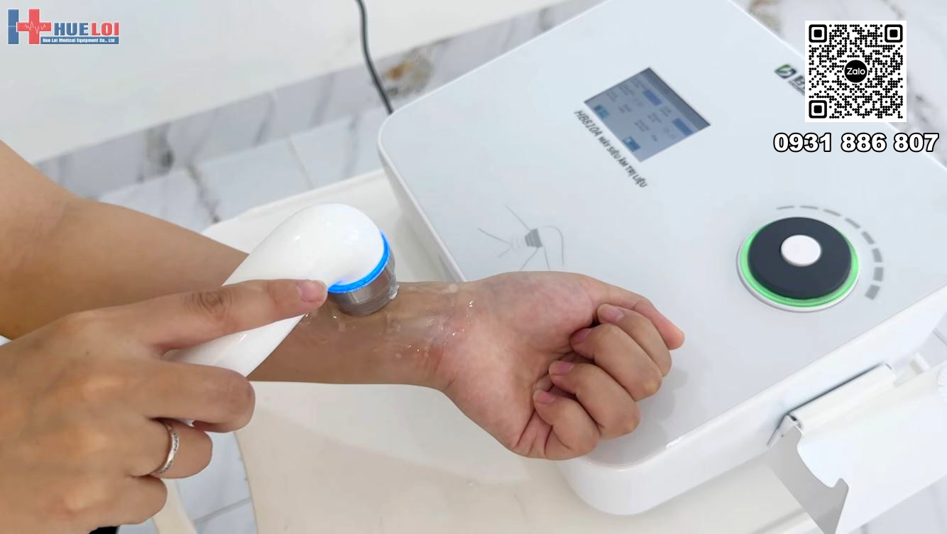 máy siêu âm trị liệu viêm khớp cổ tay