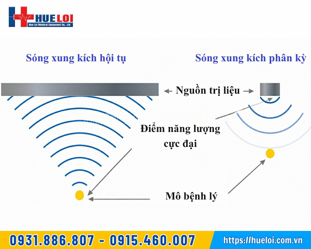 so sánh máy xung kích hội tụ và máy xung kích phân kỳ