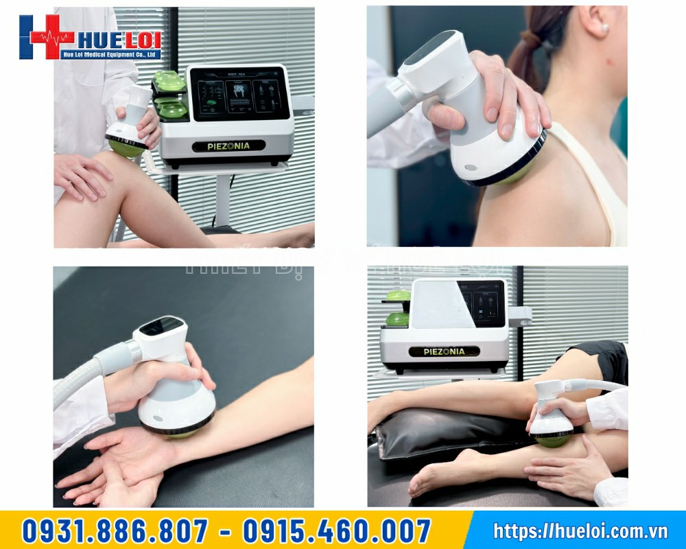 các vùng điều trị trên cơ thể khi sử dụng máy xung kích hội tụ