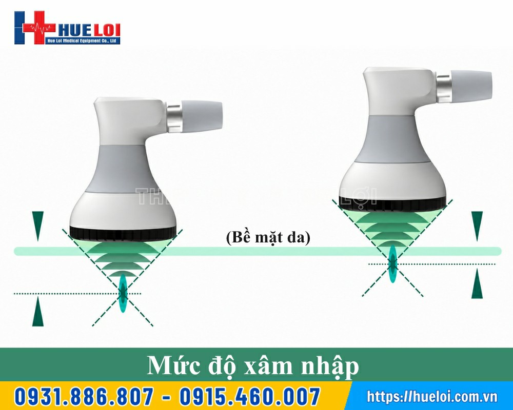 ưu điểm của máy sóng xung kích hội tụ PIEZONIA