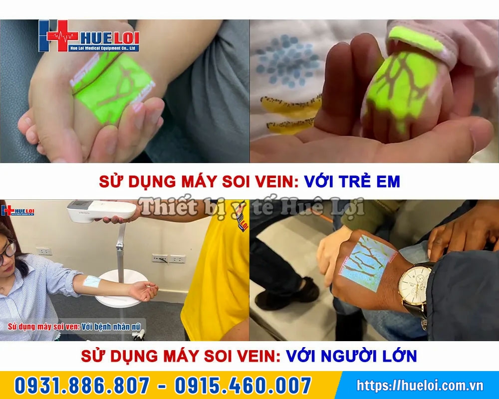 máy soi vein tìm tĩnh mạch 