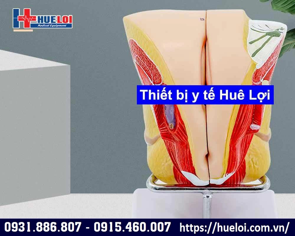 mô hình hệ sinh sản nữ