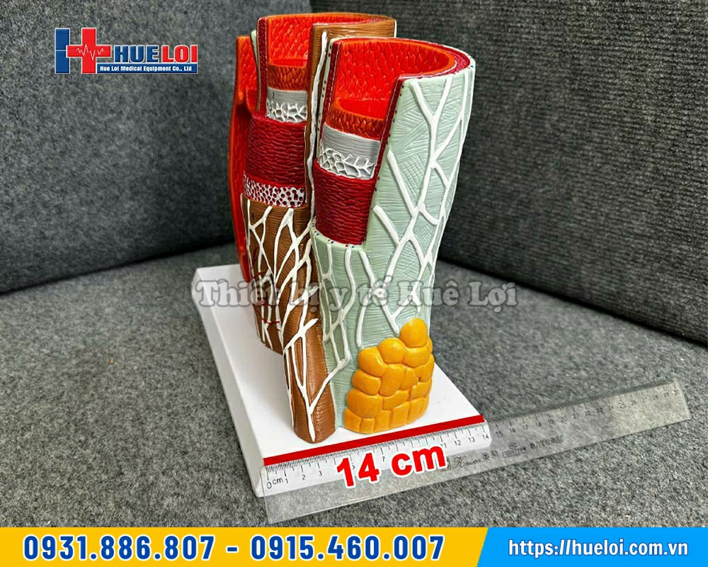 kích thước thành mạch phóng đại